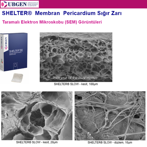 UBGEN Shelter-S Pericardium Membran  15 x 20 - 0.4mm.  10 Adet