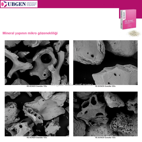 UBGEN Cortico-Can. Kal�n 1-2mm. 5 gr. 12 cc KAMPANYA 10+1 Adet