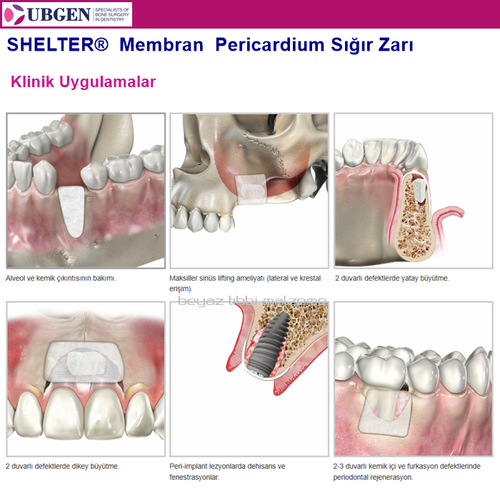 UBGEN Shelter-S Pericardium Membran  15 x 20 - 0.4mm.  10 Adet