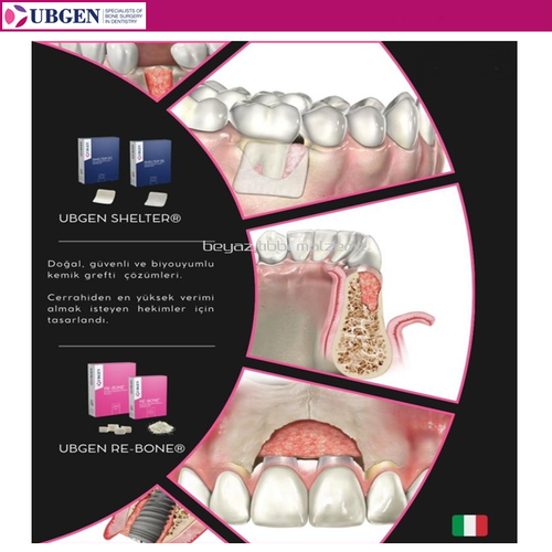 UBGEN Cortico-Can. Kal�n 1-2mm. 5 gr. 12 cc KAMPANYA 10+1 Adet