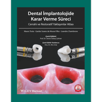 Ankara Nobel Tıp Kitabevi  Dental İmplantolojide Karar Verme Süreci Cerrahi ve Restoratif Yaklaşımlar Atlası Deniz Özbay Çetiner