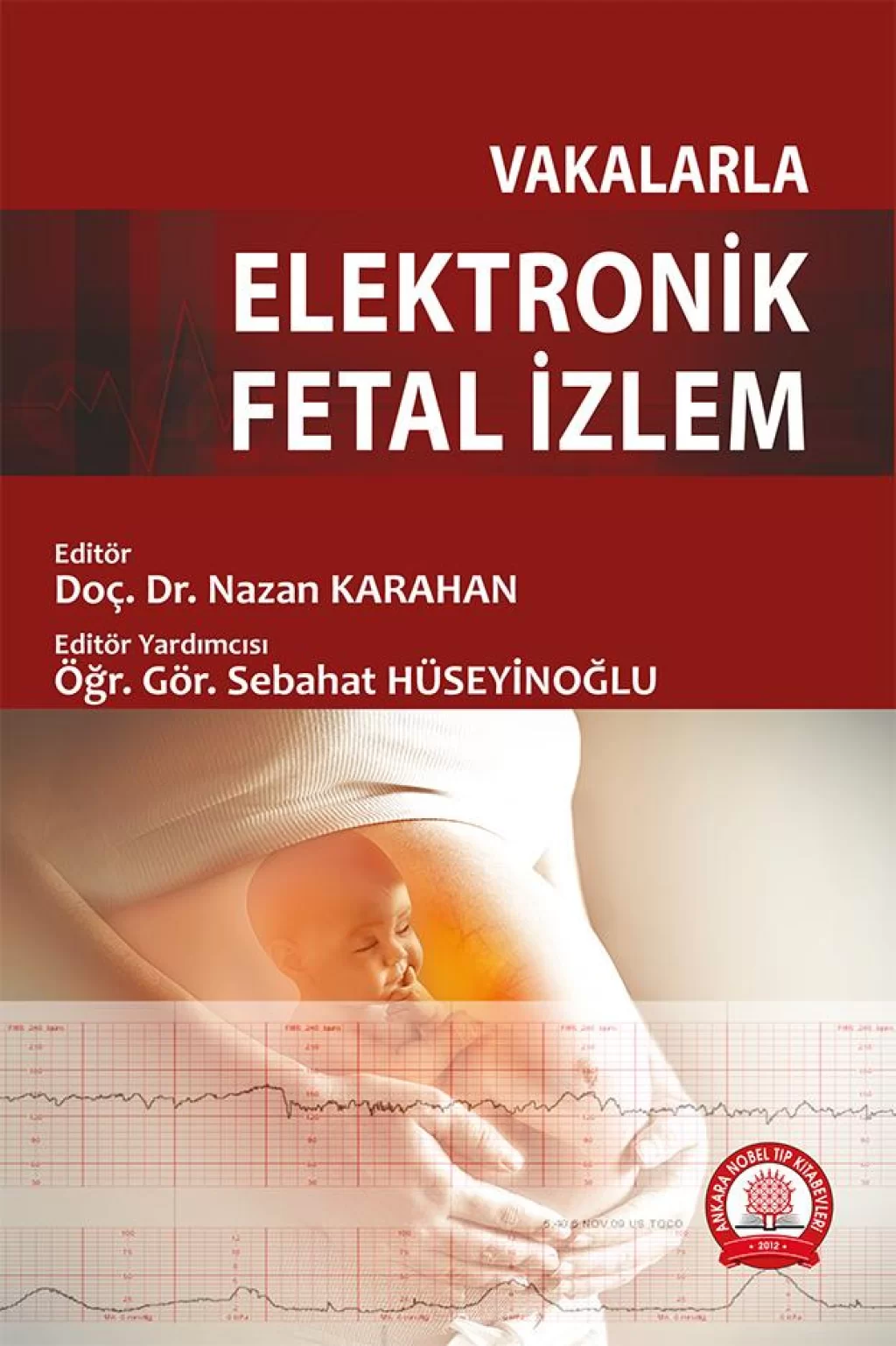 Vakalarla Elektronik Fetal İzlem/Ankara Nobel Tıp Kitabevleri