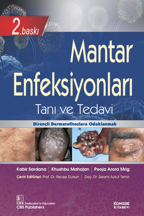 Mantar Enfeksiyonları Tanı ve Tedavi (Kabir Sardana) Kongre Tıp Kitabevi