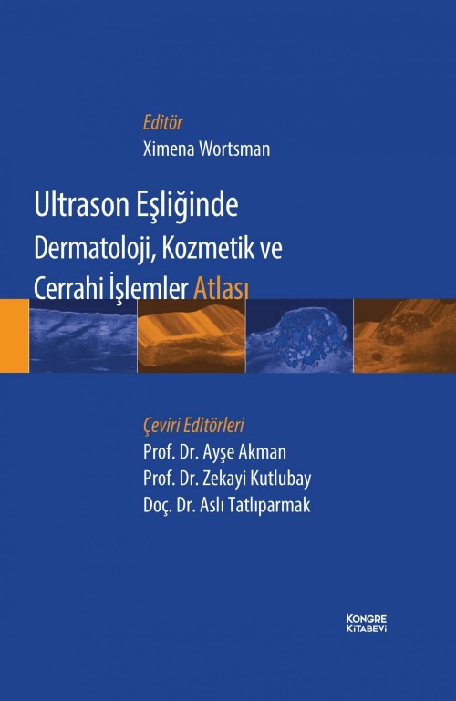 Ultrason Eşliğinde Dermatoloji,Kozmetik ve Cerrahi İşlemler Atlası (Ayşe Akman) Kongre Tıp Kitabevi