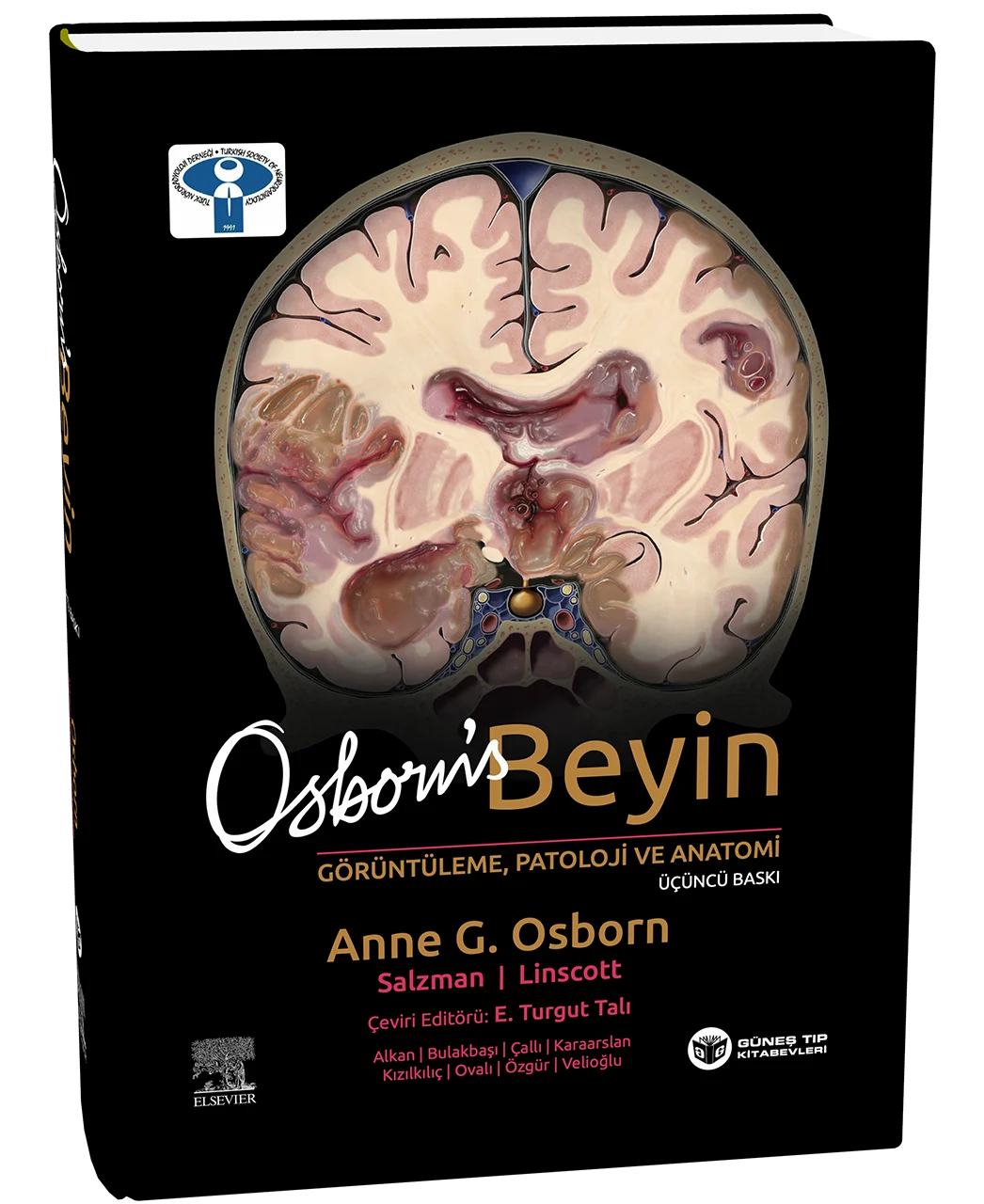 Osborn's Beyin Görüntüleme, Patoloji ve Anatomi 3. Baskı