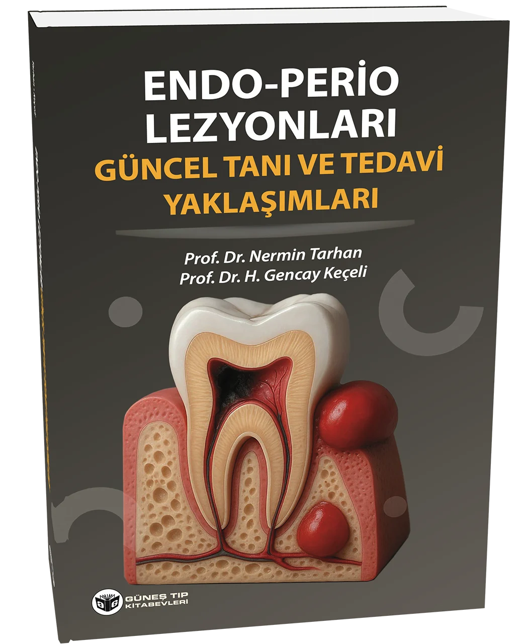 Endo - Perio Lezyonları Güncel Tanı ve Tedavi Yaklaşımları