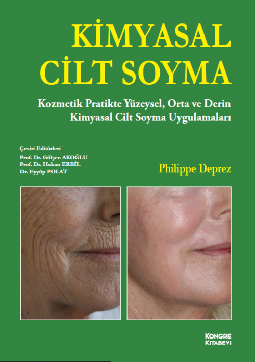 Kimyasal Cilt Soyma (Gülşen AKOĞLU) Kongre Tıp Kitabevi