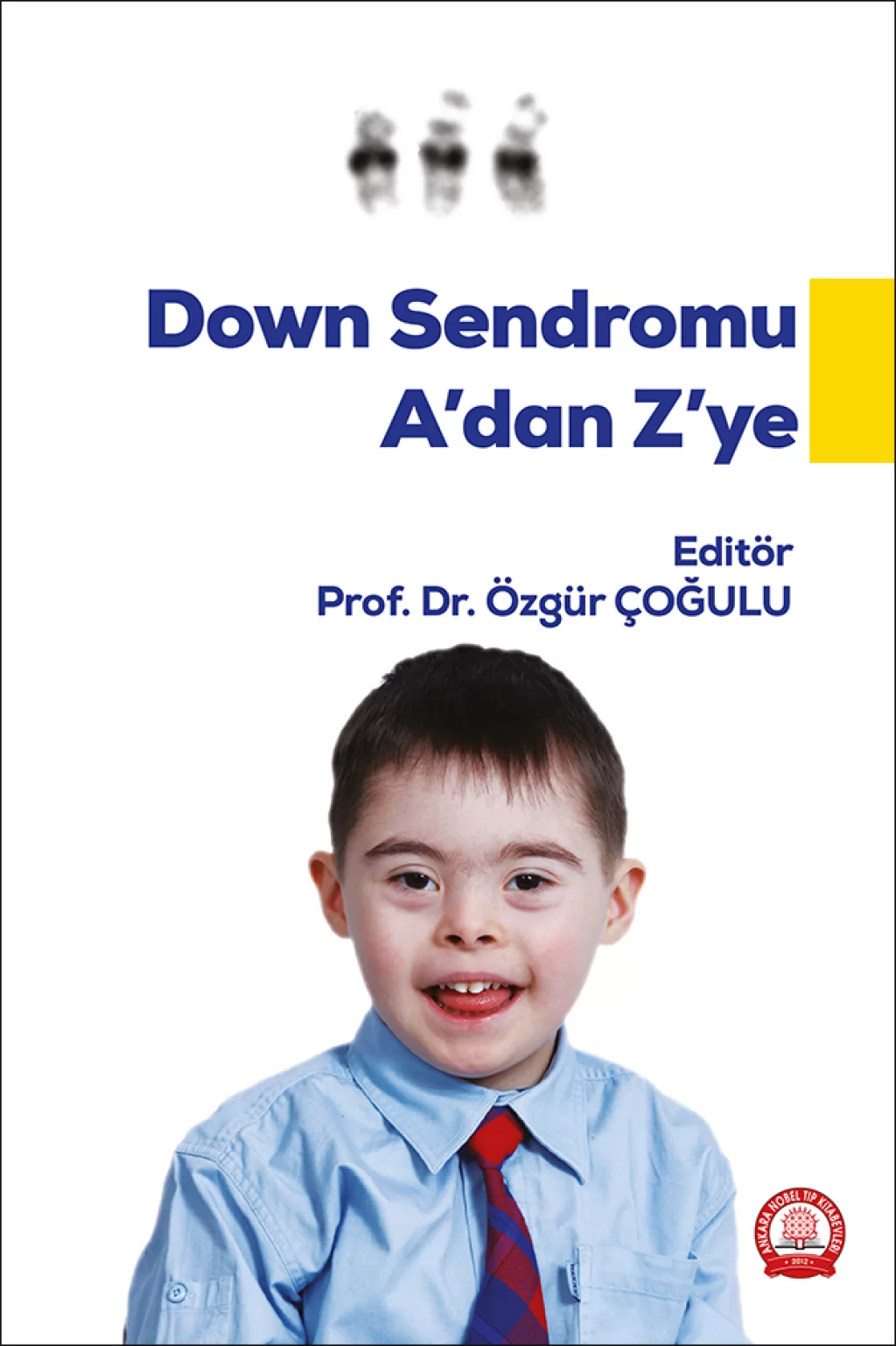 Down Sendromu A dan Z ye (Özgür Çoğulu) /Ankara Nobel Tıp Kitabevleri