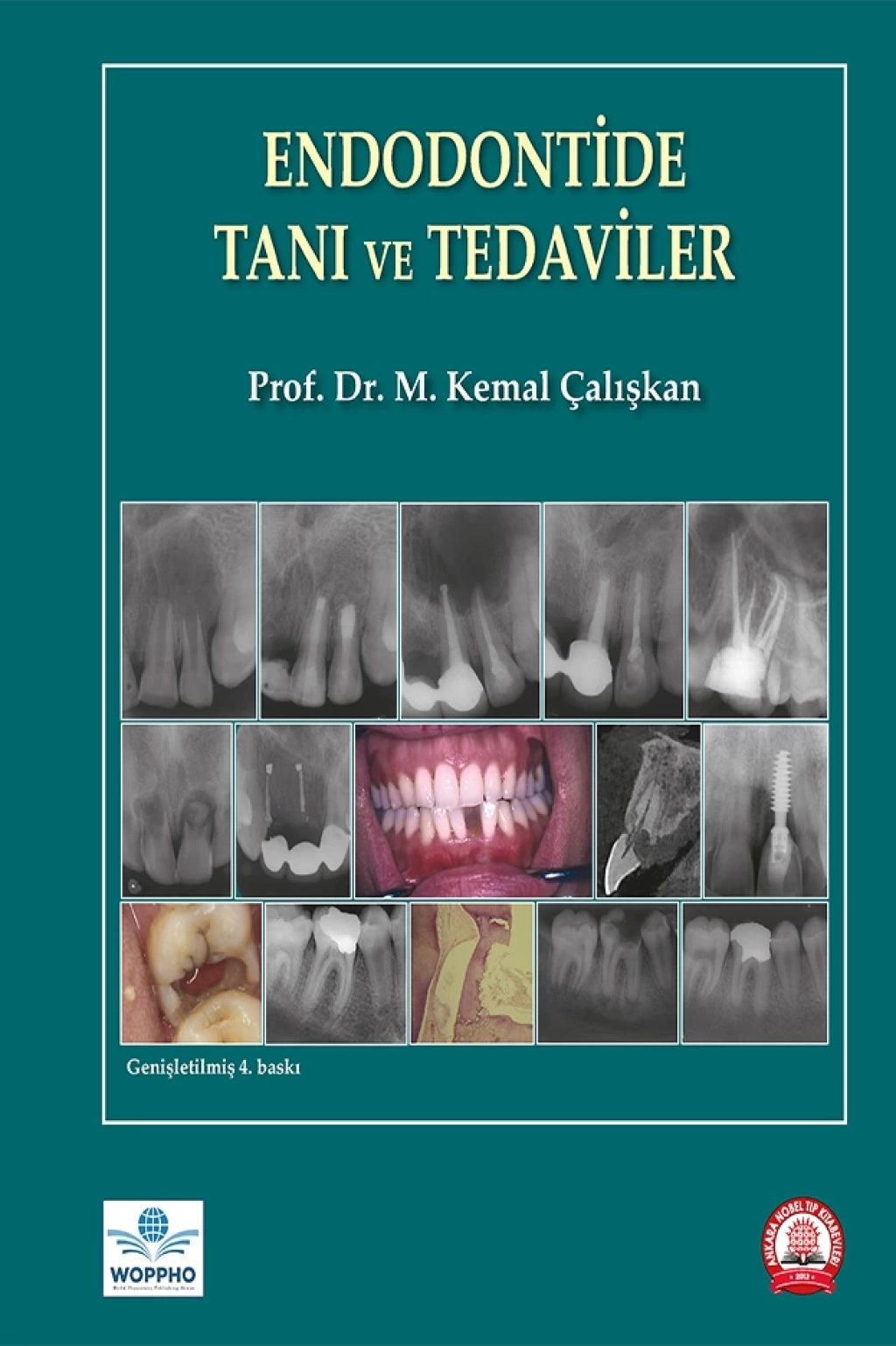 Endodontide Tanı ve Tedaviler (M. Kemal ÇALIŞKAN)