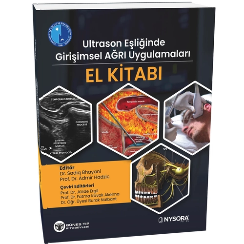 Ultrason E�li�inde Giri�imsel A�r� Uygulamalar� El Kitab�