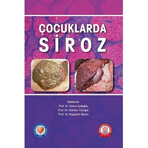ocuklarda Siroz-Sema Aydodu ,Gkhan Tmgr ,Maallah Baran