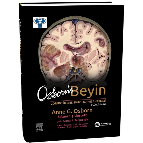 Osborn's Beyin G�r�nt�leme, Patoloji ve Anatomi 3. Bask�
