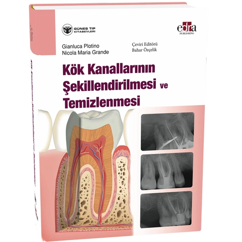 K�k Kanallar�n�n �ekillendirilmesi ve Temizlenmesi (Bahar �z�elik)