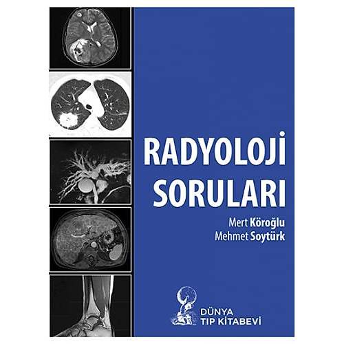 Radyoloji Sorular Mert Krolu, Mehmet Soytrk