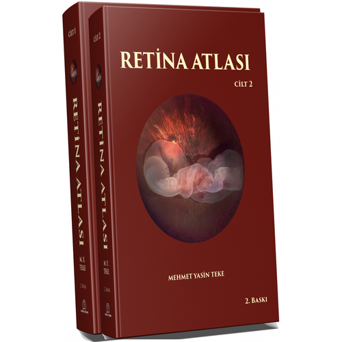 Retina Atlası 1 - 2 Cilt
