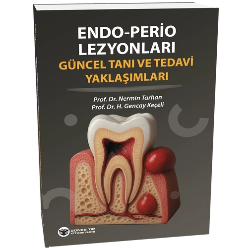 Endo - Perio Lezyonlar� G�ncel Tan� ve Tedavi Yakla��mlar�