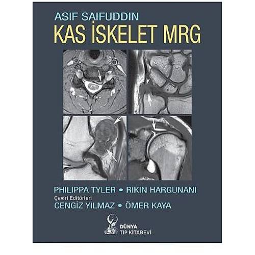 Kas �skelet MRG-Cengiz Y�lmaz