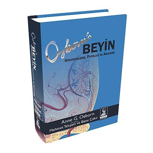 Osborn Beyin: Grntleme, Patoloji ve Anatomi