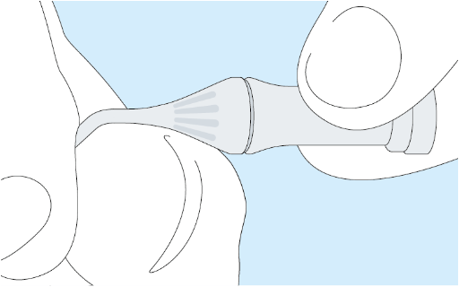 DMG Retraksiyon Pastas�