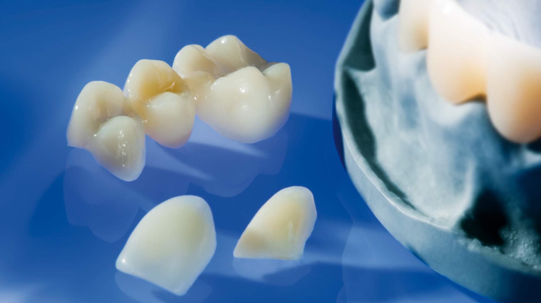 DMG Luxatemp Glaze & Bond