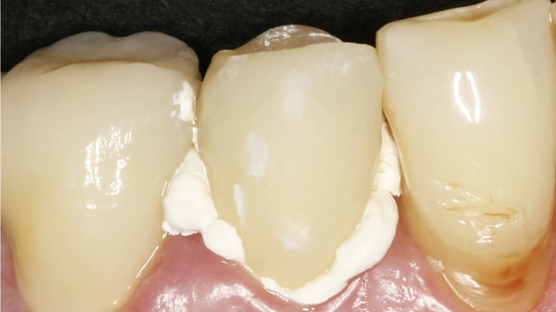 DMG TempoCem NE Smartmix