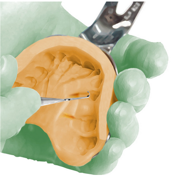 KETTENBACH Panasil Putty Fast Takm (1.L+2.L)