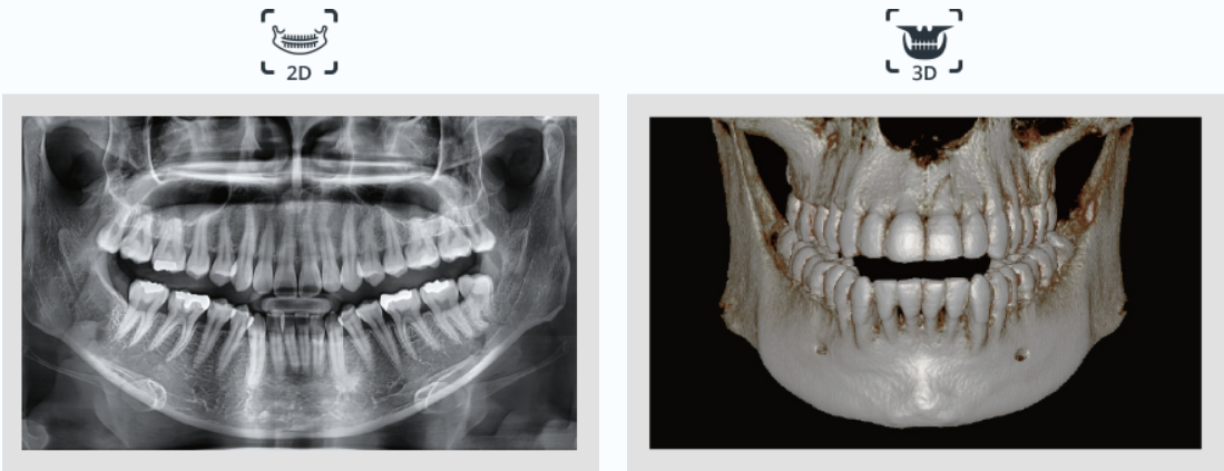 Снимок клкт. Компьютерная томография челюстей VATECH. Снимок челюстей на аппарате VATECH. Кт нижней челюсти на аппарате VATECH. Интраоральные 3d-снимки.