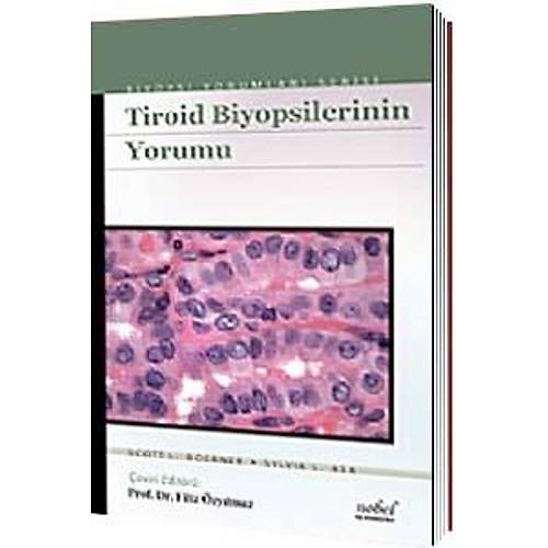 NOBEL TIP TROD BYOPSLERNN YORUMU - BYOPS YORUMLARI SERS - FLZ ZYILMAZ 