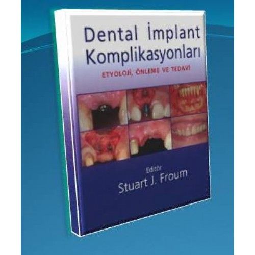 KİTAP- Dental İmplant Komplikasyonları - Stuart J.Froum