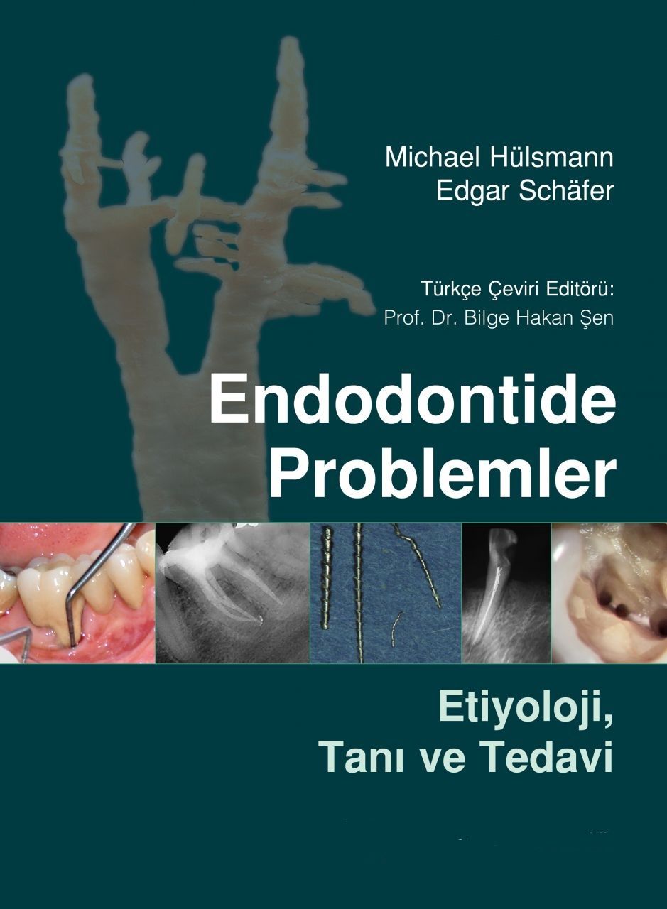 KİTAP- Endodontide Problemler - Etiyoloji, Tanı ve Tedavi -Michael Hülsmann Edgar Schäfer