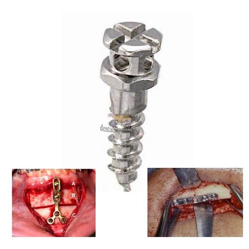 Tri-Med Kemik Fiksasyonu Vidası (Çap:1,6 ,Boy: 15 Mm) 4 Alana 1 Hediye