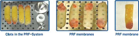 SURGIDENT Prf İçin İşleme Kutusu Prf Box