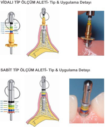 RHEIN 83 CH Dişeti Mesafesi Ölçüm El Aleti Set