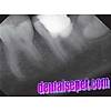 G�rsel 4