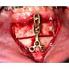 G�rsel 4