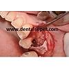 G�rsel 11