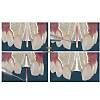 G�rsel 3