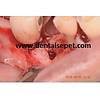 G�rsel 13