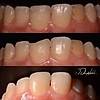 G�rsel 3