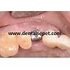 G�rsel 15