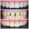 G�rsel 14