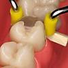 G�rsel 1