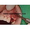 G�rsel 21