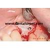 G�rsel 18