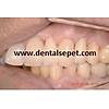 G�rsel 14