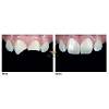 G�rsel 4