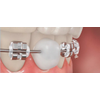 G�rsel 3