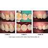 G�rsel 23