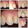 G�rsel 6