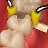 G�rsel 1